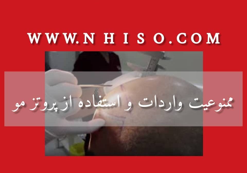 اداره کل از ممنوعیت واردات و استفاده پروتز مو خبر دارد